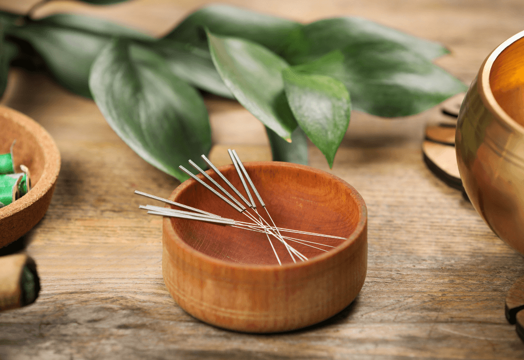 Acupuncture au cabinet de Pessac