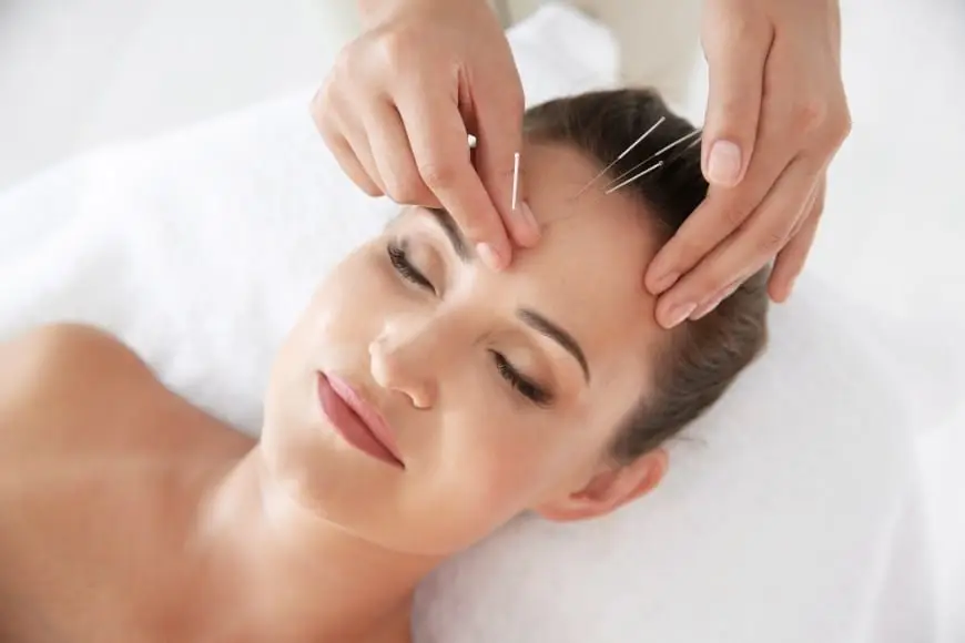 Acu-lifting et soins du visage