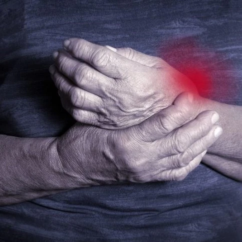 Arthralgies et polyarthrite rhumatoïde